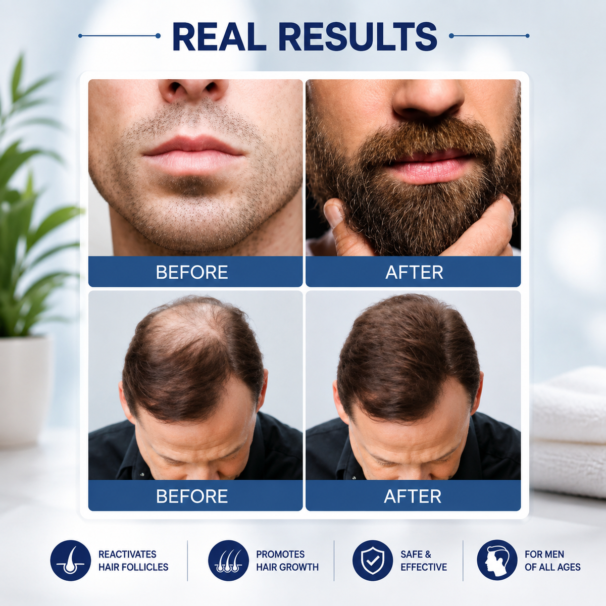 Kirkland Minoxidil 5% Extra Strength for Men – 6 Month Supply, 2 Pack