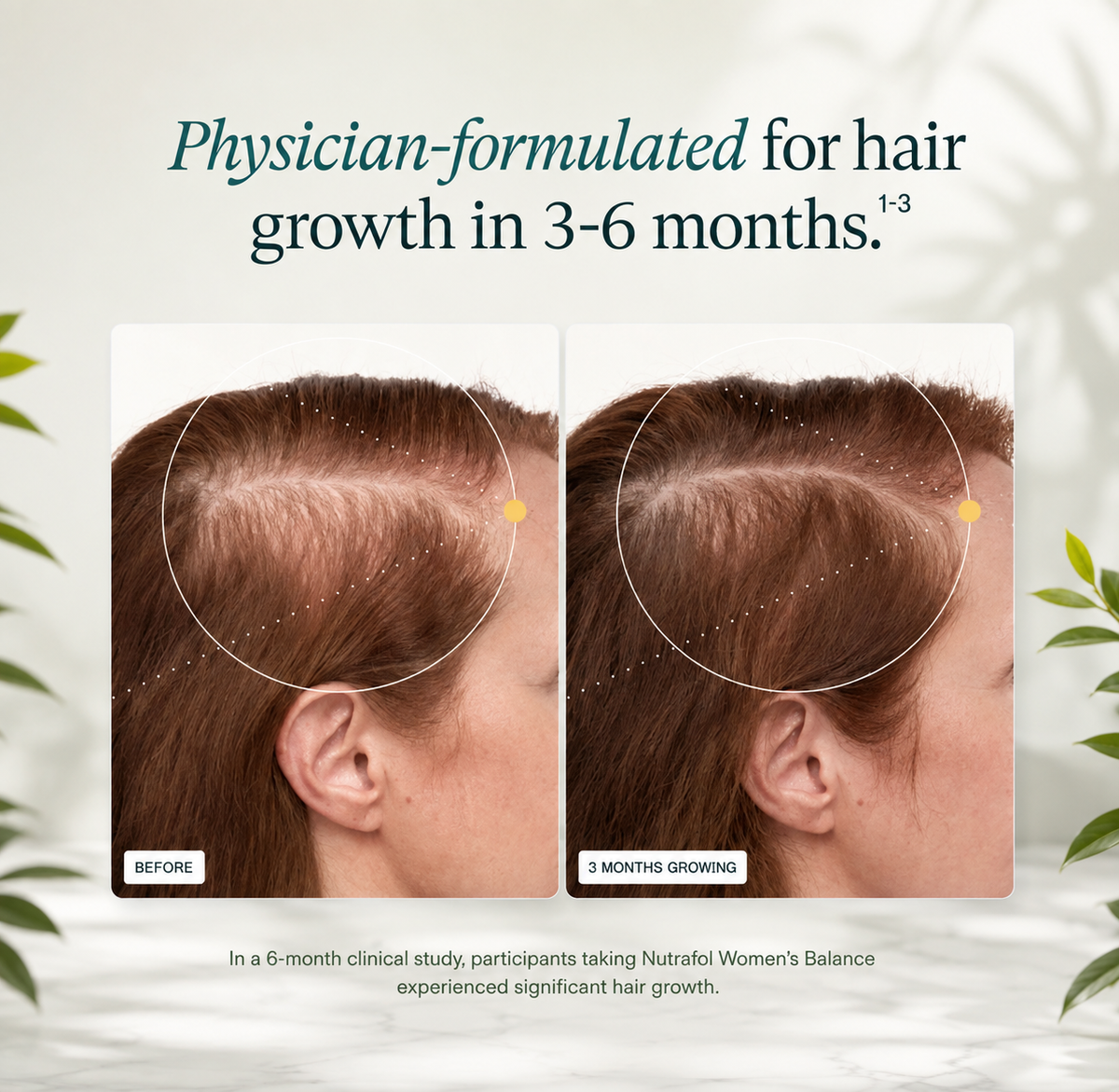 Nutrafol Women’s Balance Hair Growth Supplement – For Women 45+
